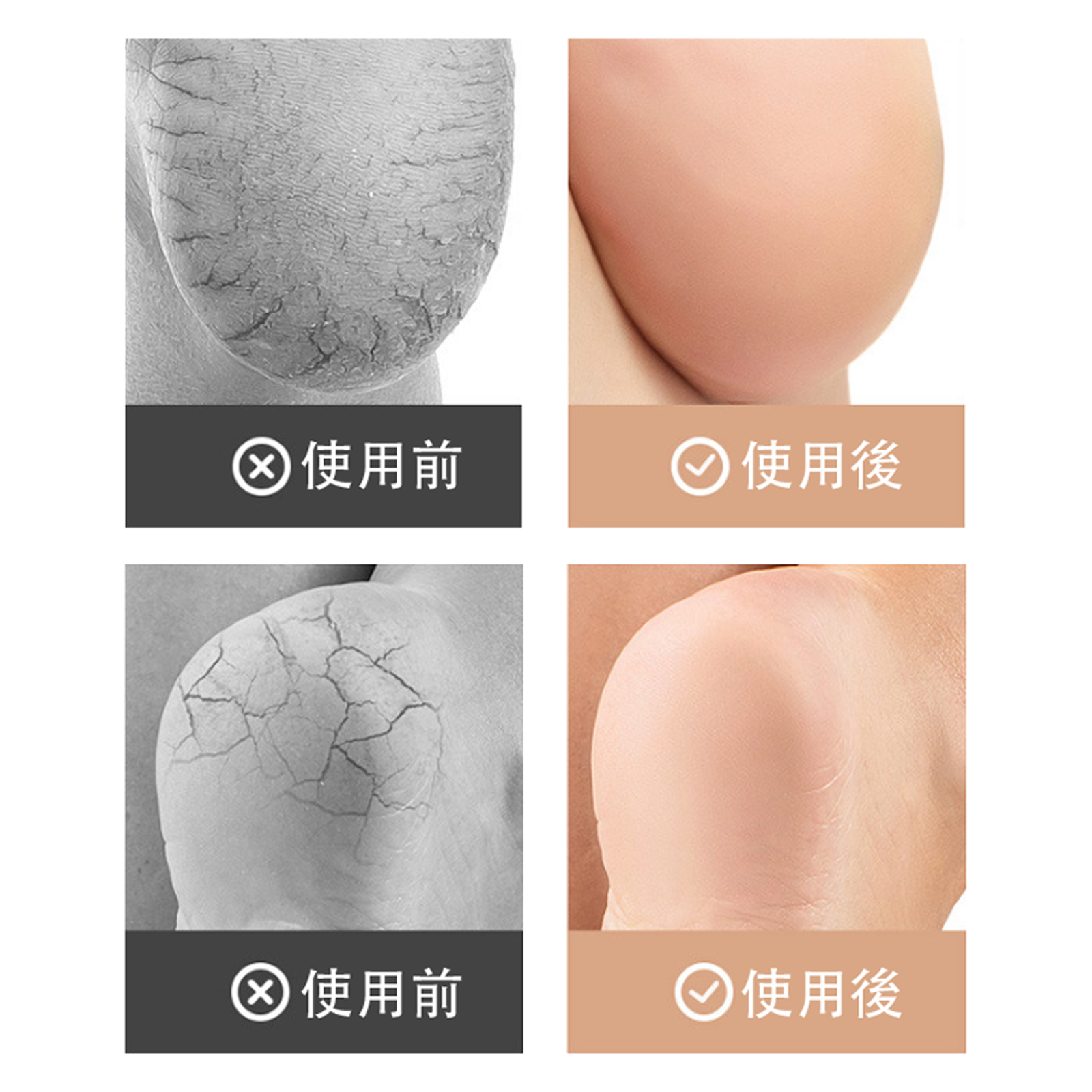 【2足4枚セット】かかとケア サポーター 保湿 ひび割れ防止 ソックス